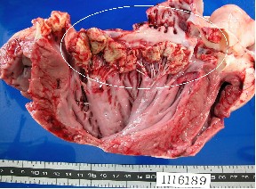 内臓及び枝肉検査(とさつ後)から敗血症の写真